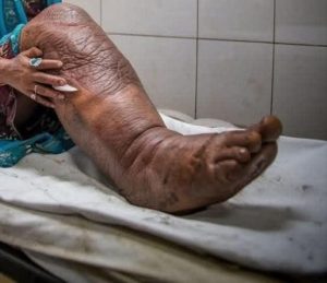 HT2: These Are the Consequences of Sleeping on the Warning Signs Your Feet Are Screaming About