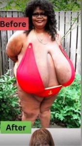 Obesity Is Rapidly Becoming One of the Biggest Health Threats in the World, Experts Warn