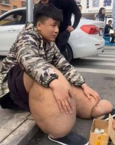 The Consequences of Sleeping With the Wrong Person