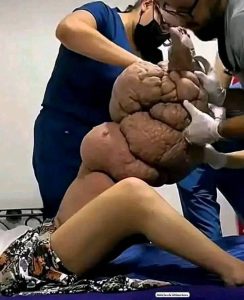 These are the reasons for sleeping with a 1…See more