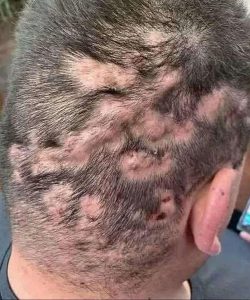 These are the first symptoms